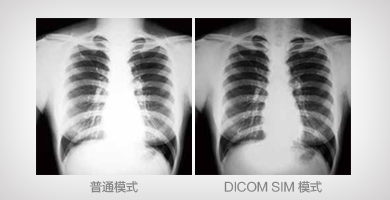 DICOM SIM模式 - Epson CB-G7100產(chǎn)品功能